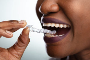 woman with clear dental aligner